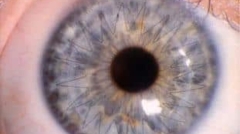 Corneal Transplantation PKT training course